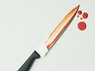 Нож. Фото: trend.az Нож. Фото: trend.az